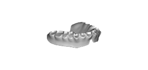 Full Dentures